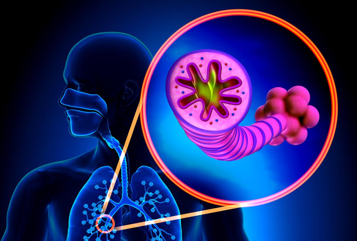 banner of Understand Eosinophilic Asthma