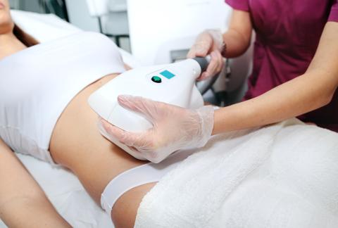 square of CoolSculpting: A Solution to Fat Reduction