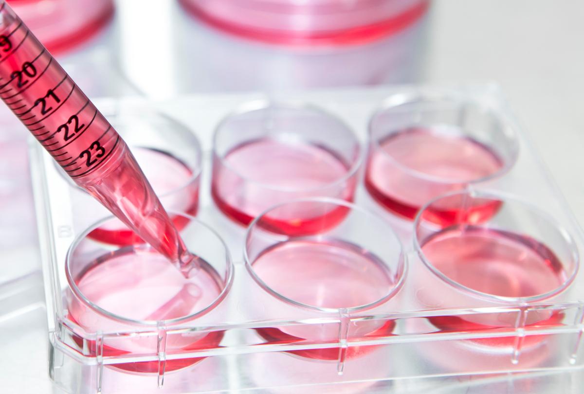 banner of Fluorescent ELISA Kits