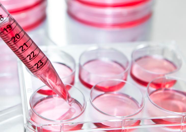 thumbnail of Fluorescent ELISA Kits